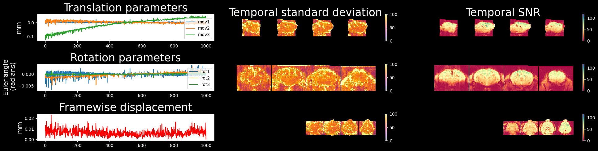 Motion parameter timecourses, framewise displacement, variability and tSNR maps