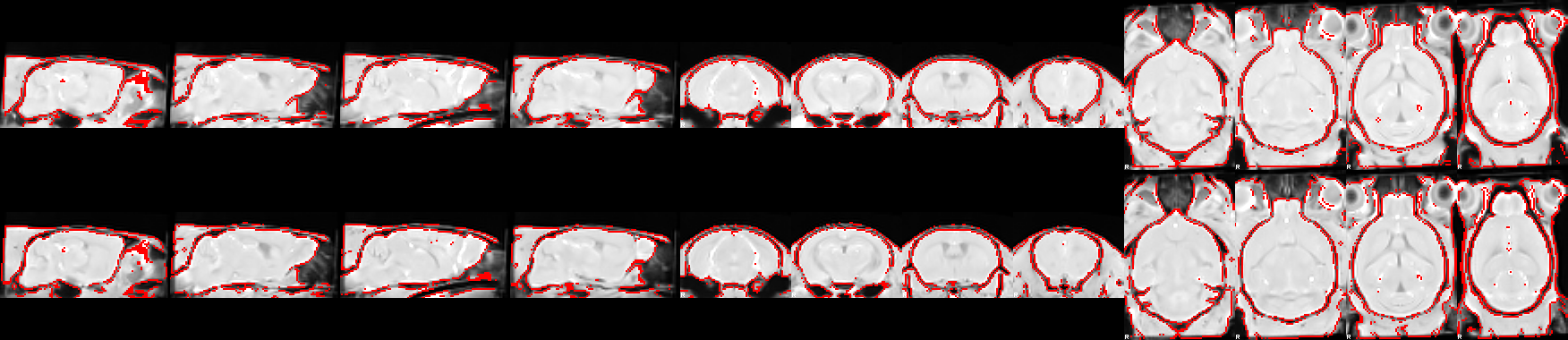 Overlap between a structural scan and the dataset-generated unbiased template