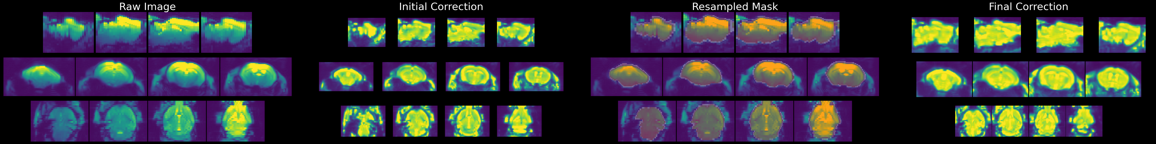 Four-column figure showing the stages of EPI inhomogeneity correction