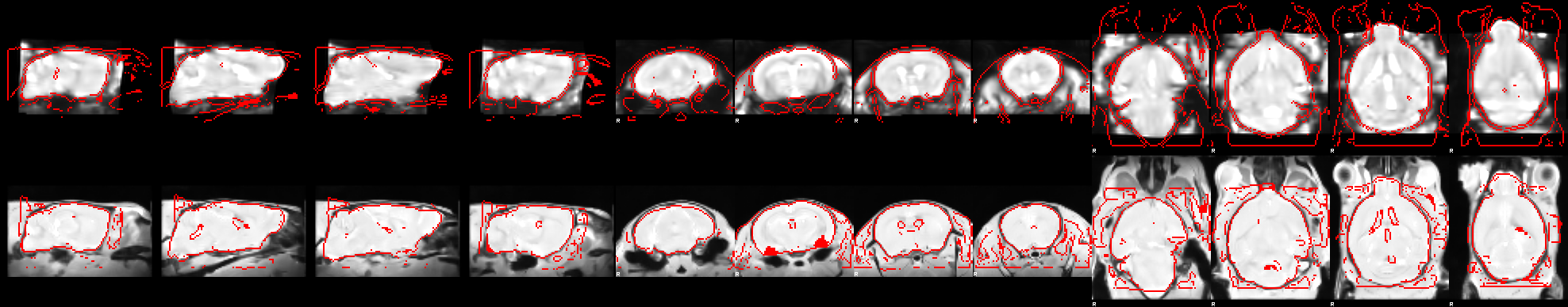 Overlap between the volumetric EPI and the structural image
