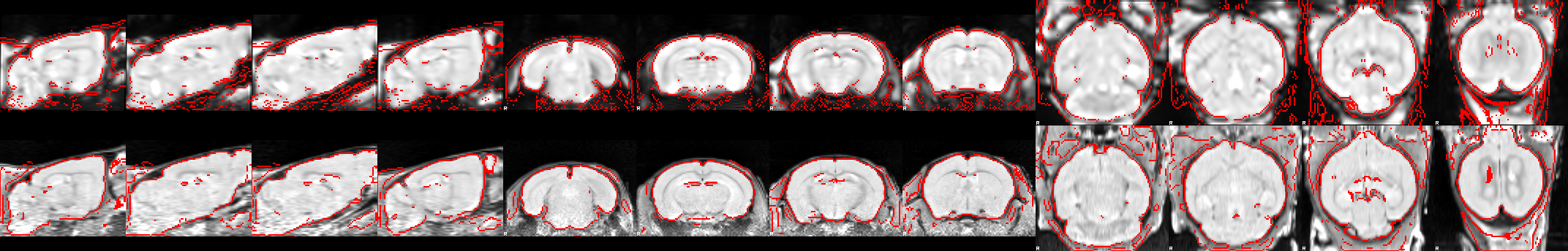 Overlap of a functional scan on its anatomical scan