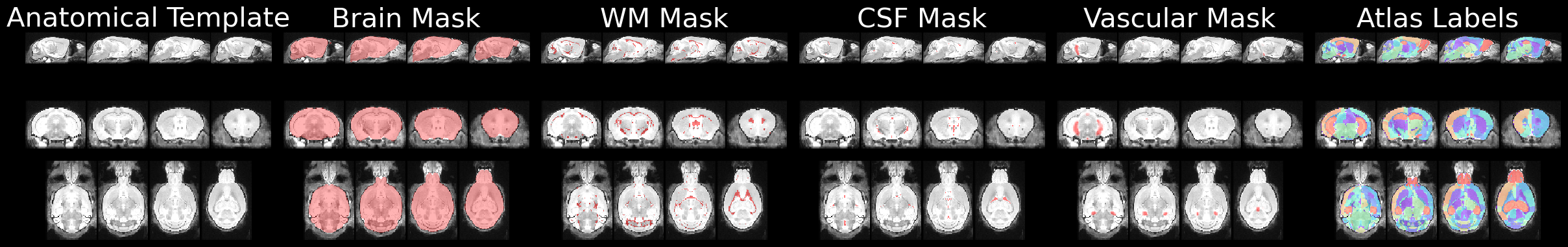 The anatomical template overlaid with its masks and labels