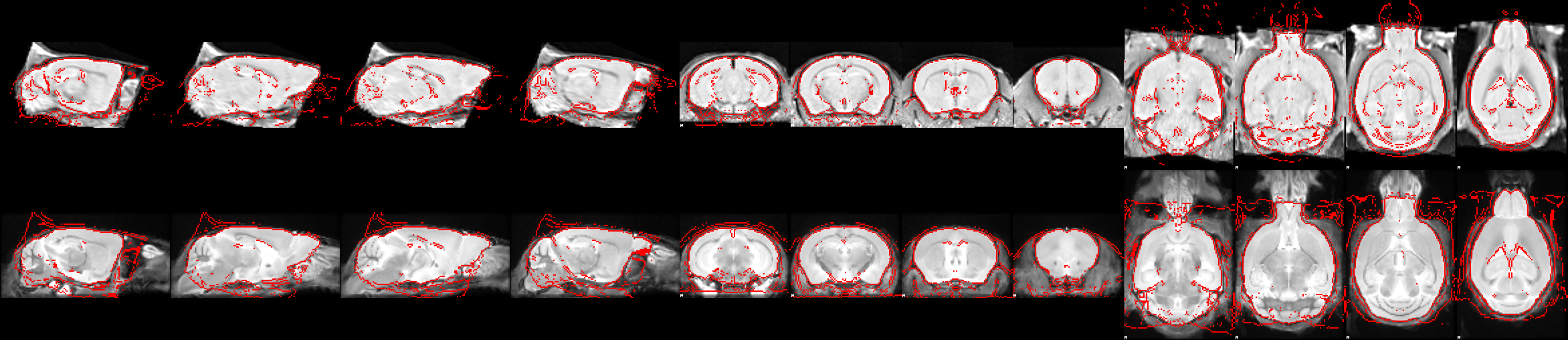 Overlap of the study template on the reference atlas